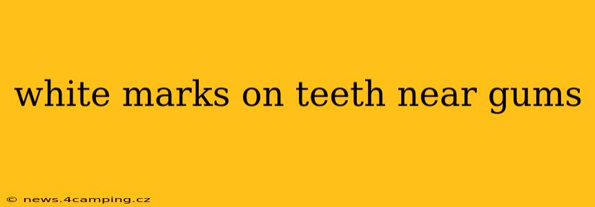 white marks on teeth near gums