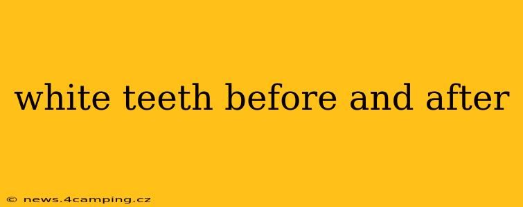 white teeth before and after