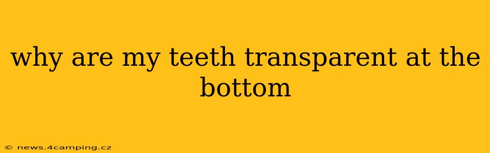 why are my teeth transparent at the bottom
