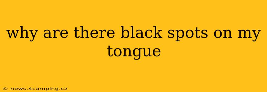why are there black spots on my tongue