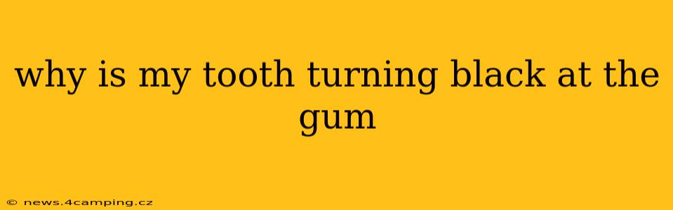 why is my tooth turning black at the gum