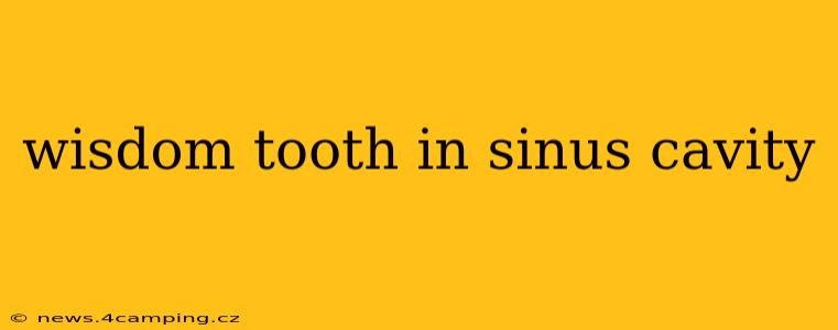 wisdom tooth in sinus cavity